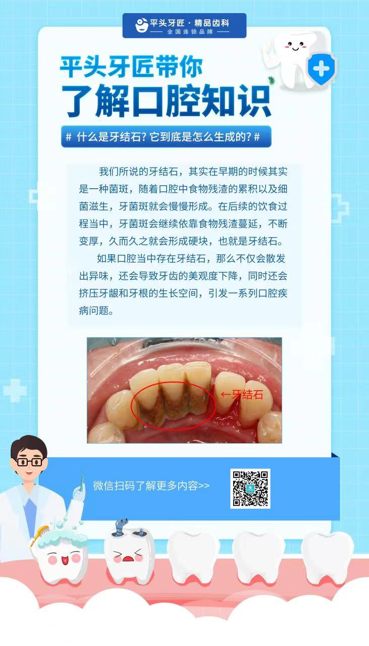 平头牙匠带你了解什么是“牙结石” 