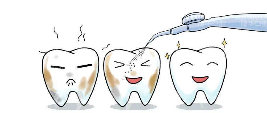洁牙能减轻口臭吗？武汉平头牙匠洁牙多少钱？ 